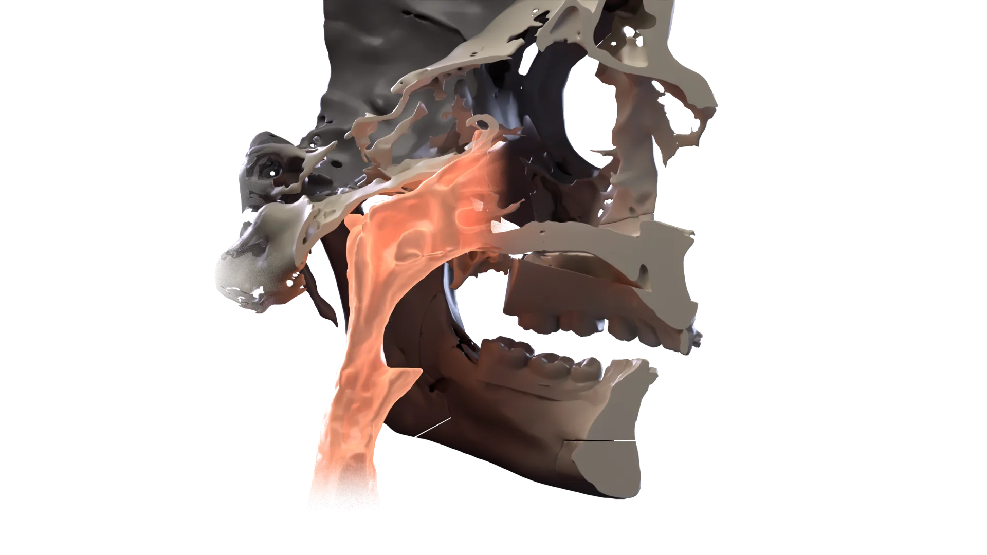 Imagen 3D: Guías impresas en 3D